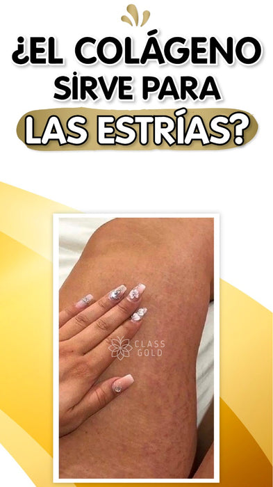 Class Gold | Aceite Multibeneficios Pequeño
